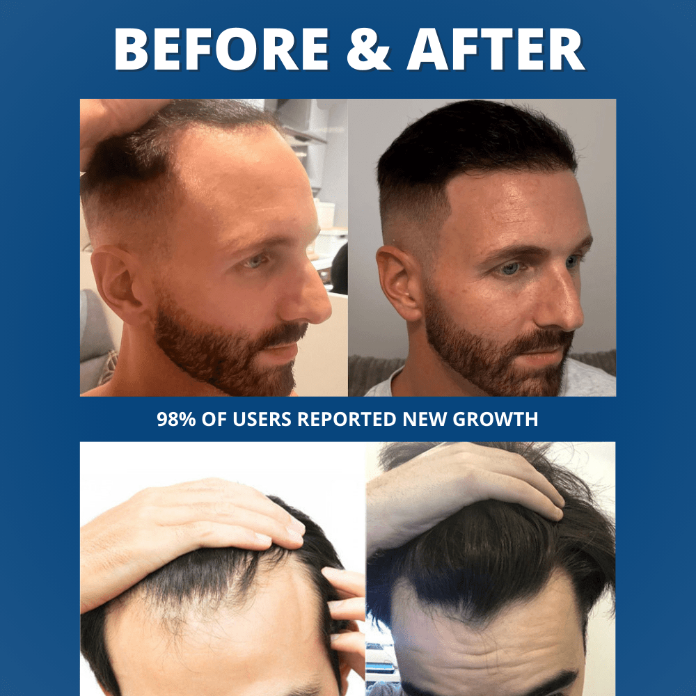 Hair Growth Serum - bebodywise - us.com