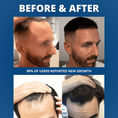 Hair Growth Serum - bebodywise - us.com